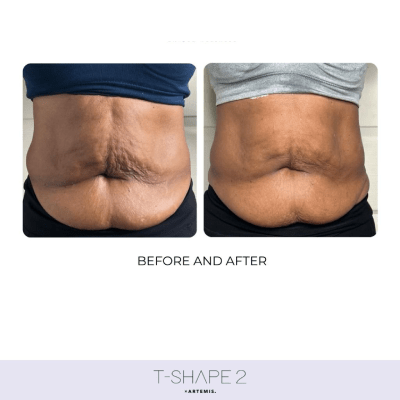 T-SHAPE 2